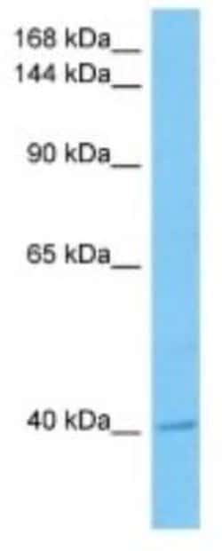 DFNB31 Rabbit anti-Mouse, Polyclonal, Novus Biologicals:Antibodies:Primary